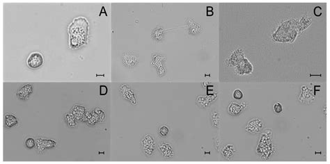  Acanthamoeba: ¡Un microorganismo invisible que controla el mundo a través de falsas patas!