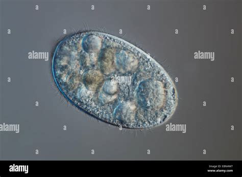 Ever wondered how an amoeba can move and feed without any traditional limbs or mouths? Prepare to be amazed by Euglypha, a captivating single-celled organism that defies expectations!